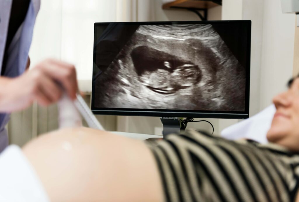 Patient seeing baby with an ultra-sound